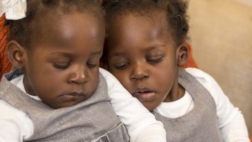 Apio (left) and Acen (right) Akello were once conjoined, but after their surgery at Nationwide Children`s Hospital, they can now choose when to be together and apart.
